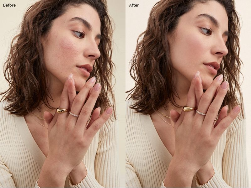 A "Before and After" comparison image showing a woman with her hands clasped. The "Before" image shows slight skin imperfections, while the "After" image displays smoother, retouched skin